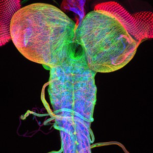 Dr. Christian Klämbt and Dr. Imke Schmidt University of Münster, Münster, Germany Specimen: Beta-tubulin expression of a Drosophila third instar larval brain, with attached eye imaginal discs.